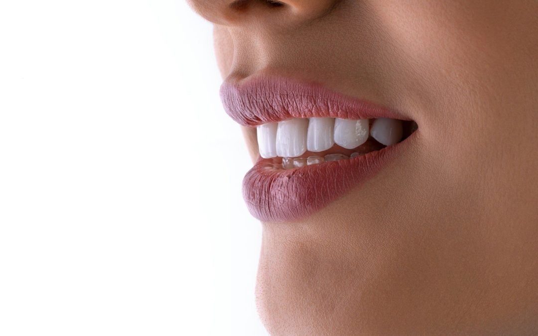 a close up of a woman's mouth with white teeth