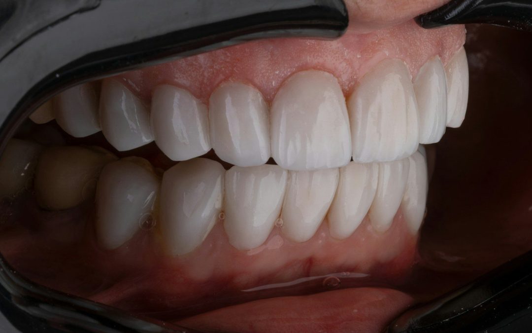 a person's mouth with teeth